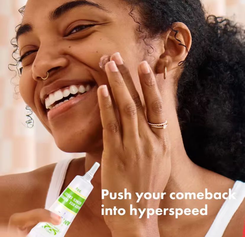 30g Acne Cream soothes, hydrates, helps regulate oil, reduces redness, and enhances skin texture with a moisturizing feel30g Acne Cream soothes, hydrates, helps regulate oil, reduces redness, and enhances skin texture with a moisturizing feelvvvvv